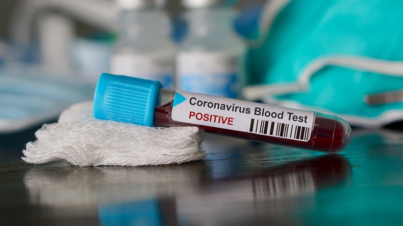 Coronavirus (SamaraHeisz5/Shutterstock.com)